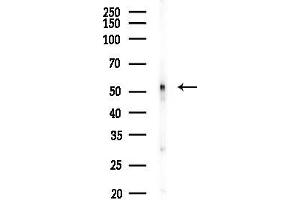 anti-Cannabinoid Receptor 1 (CNR1) (N-Term) antibody