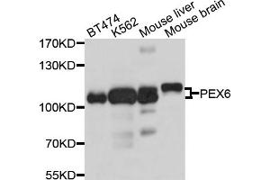 Western blot analysis of extracts of various cell lines, using PEX6 antibody (ABIN4904736) at 1:1000 dilution. (PEX6 antibody)