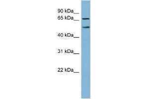 WB Suggested Anti-MYST1 Antibody Titration:  0.