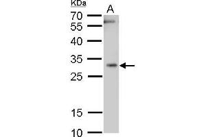 WB Image Heme Oxygenase 1 antibody detects Heme Oxygenase 1 protein by western blot analysis. (HMOX1 antibody)