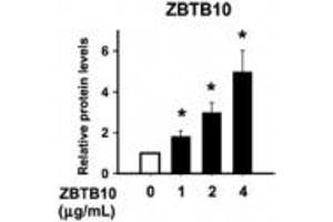 Image no. 1 for anti-Zinc Finger and BTB Domain-Containing Protein 10 (ZBTB10) (AA 62-77) antibody (ABIN960410) (ZBTB10 antibody  (AA 62-77))