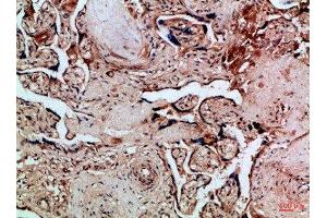 Immunohistochemical analysis of paraffin-embedded Human-placenta, antibody was diluted at 1:100 (FLT4 antibody  (AA 720-760))