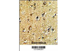 Formalin-fixed and paraffin-embedded human brain tissue with TH Antibody , which was peroxidase-conjugated to the secondary antibody, followed by DAB staining. (TH antibody  (C-Term))