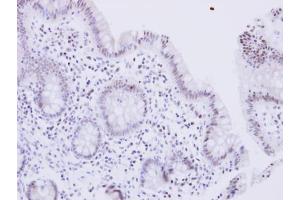 IHC-P Image WRN antibody detects WRN protein at nucleus on human normal colon by immunohistochemical analysis. (RECQL2 antibody  (Center))
