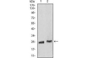 Western Blotting (WB) image for anti-RAB5A, Member RAS Oncogene Family (RAB5A) (AA 1-215) antibody (ABIN5876083) (RAB5 antibody  (AA 1-215))