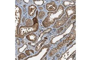 Immunohistochemical staining of human kidney with C10orf90 polyclonal antibody  shows strong cytoplasmic positivity in cells in tubules.