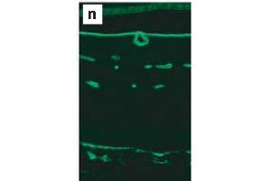 Immunohistochemistry image of Laminin YI staining in paraffin section of a 18 month-old mouse retina. (Laminin gamma 1 antibody)