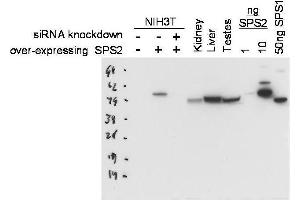 Western blot using  Protein A purified anti-SPS2 antibody shows detection of SPS2 in NIH3T3 cells over-expressing this protein.