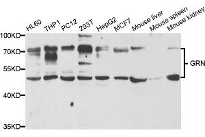 Western blot analysis of extracts of various cell lines, using GRN antibody (ABIN5973395) at 1/1000 dilution. (Granulin antibody)