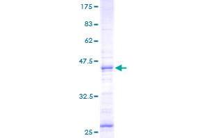 Image no. 1 for Neuromedin U (NMU) (AA 36-174) protein (GST tag) (ABIN1312730) (Neuromedin U Protein (NMU) (AA 36-174) (GST tag))