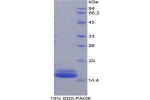 SDS-PAGE analysis of Mouse FABP4 Protein.