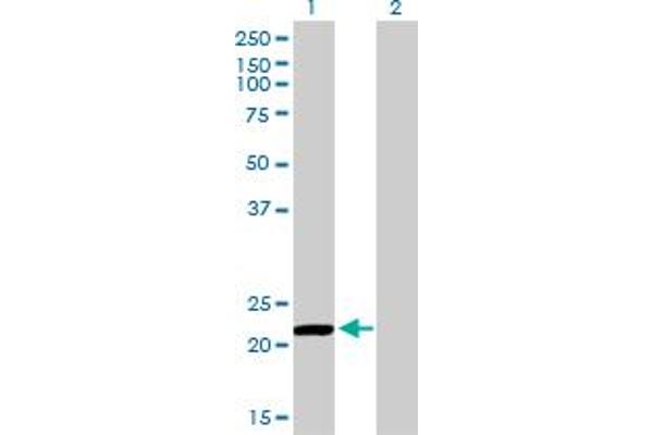 Peroxiredoxin 2 antibody  (AA 1-198)