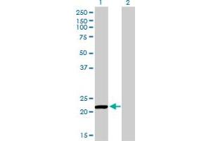 Western Blot analysis of PRDX2 expression in transfected 293T cell line by PRDX2 monoclonal antibody (M01), clone 4E10-2D2. (Peroxiredoxin 2 antibody  (AA 1-198))