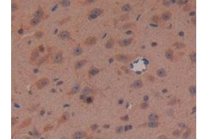 Detection of APC in Mouse Brain Tissue using Polyclonal Antibody to Adenomatosis Polyposis Coli Protein (APC) (APC antibody  (AA 2636-2845))