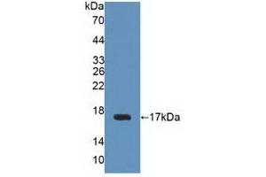 Figure. (Uroplakin 2 antibody  (AA 26-153))
