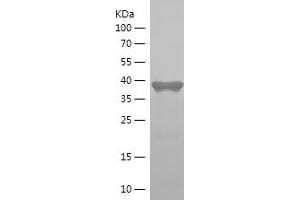 Western Blotting (WB) image for Peroxisome Proliferator-Activated Receptor Gamma, Coactivator-Related 1 (PPRC1) (AA 1044-1159) protein (His-IF2DI Tag) (ABIN7282733) (PPRC1 Protein (AA 1044-1159) (His-IF2DI Tag))