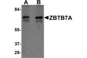 Western blot analysis of ZBTB7A in Human ovary tissue lysate with ZBTB7A / Pokemon antibody at (A) 1 and (B) 2 μg/ml. (ZBTB7A antibody  (N-Term))