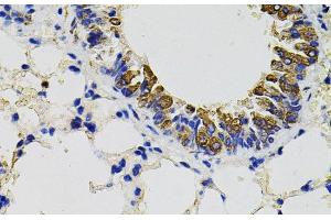 Immunohistochemistry of paraffin-embedded Mouse lung using CD59 Polyclonal Antibody (CD59 antibody)