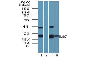 Rab-7 Western Blot. (RAB7A antibody)