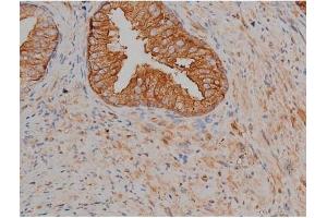 Immunohistochemistry (IHC) image for anti-Microtubule-Associated Protein tau (MAPT) (pSer404) antibody (ABIN6255310)
