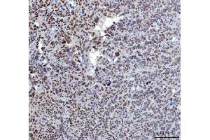 IHC analysis of YY1 using anti-YY1 antibody (ABIN7603000). (YY1 antibody  (Middle Region))