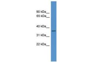 Image no. 1 for anti-Histamine N-Methyltransferase (HNMT) (AA 41-90) antibody (ABIN6746624) (HNMT antibody  (AA 41-90))