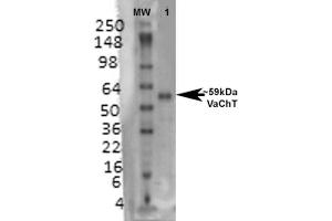 Western Blot analysis of Rat brain membrane lysate showing detection of VAChT protein using Mouse Anti-VAChT Monoclonal Antibody, Clone S6-38 (ABIN1027709).
