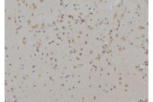 ABIN6266175 and ABIN6277197 at 1/100 staining Mouse brain tissue by IHC-P.
