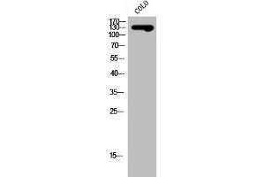 Western Blot analysis of COLO cells using SLC4A8/10 Polyclonal Antibody (SLC4A8/SLC4A1 (Internal Region) antibody)