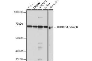 Western blot analysis of extracts of various cell lines, using KHDRBS1/KHDRBS1/Sam68 Rabbit mAb (ABIN1680037, ABIN3018237, ABIN3018238 and ABIN7101585) at 1:1000 dilution. (KHDRBS1 antibody)
