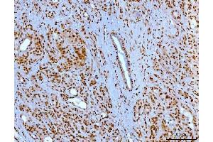 IHC analysis of YY1 using anti-YY1 antibody (ABIN7603000). (YY1 antibody  (Middle Region))