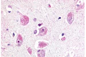 Anti-RXFP3 antibody  ABIN1049311 IHC staining of human brain, neurons and glia. (Relaxin 3 Receptor 1 antibody  (Cytoplasmic Domain))