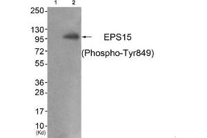 Western blot analysis of extracts from JK cells (Lane 2), using EPS15 (Phospho-Tyr849) Antibody. (EPS15 antibody  (pTyr849))