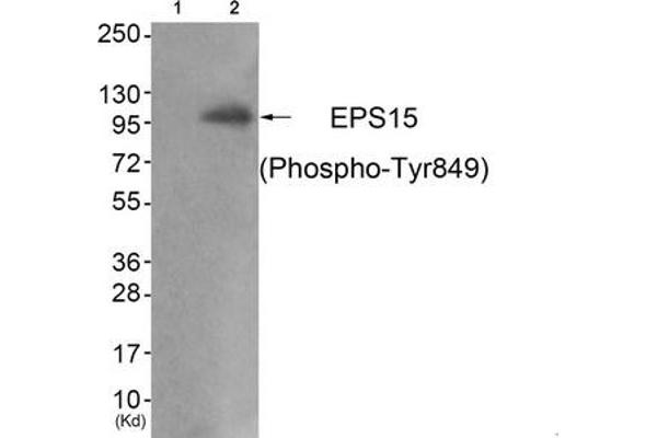 EPS15 抗体  (pTyr849)