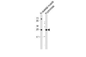 All lanes : Anti-CELA2B Antibody (Center) at 1:2000 dilution Lane 1: human skeletal muscle lysate Lane 2: human pancreas lysate Lysates/proteins at 20 μg per lane. (ELA2B antibody  (AA 88-122))