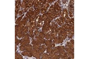 Immunohistochemical staining of human stomach with PIGN polyclonal antibody  shows strong cytoplasmic positivity in glandular cells at 1:200-1:500 dilution.