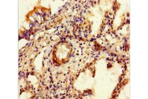 Immunohistochemistry of paraffin-embedded human lung tissue using ABIN7152342 at dilution of 1:100 (SULF1 antibody  (AA 105-372))