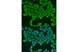 Immunofluorescence analysis of U2OS cells using ATP5O antibody. (ATP5O antibody  (AA 24-213))