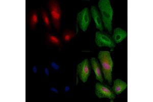 ABIN6264736 and ABIN6279770 staining  cells by IF/ICC.