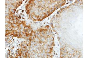 IHC-P Image Immunohistochemical analysis of paraffin-embedded SG xenograft, using EIF2 beta, antibody at 1:500 dilution. (EIF2S2 antibody)