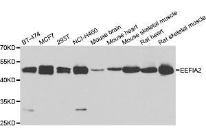 Western blot analysis of extracts of various cell lines, using EEF1A2 antibody (ABIN4903541) at 1:1000 dilution. (EEF1A2 antibody)
