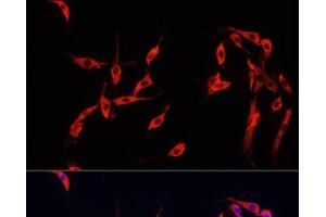 Immunofluorescence analysis of PC-12 cells using SMAD2 Polyclonal Antibody at dilution of 1:100. (SMAD2 antibody)