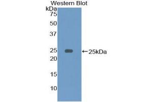 Western blot analysis of the recombinant protein. (CD79a antibody  (AA 36-219))