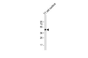 Anti-NKX2-1 Antibody (N-term) at 1:1000 dilution + TT cell nucleus lysate Lysates/proteins at 20 μg per lane. (NKX2-1 antibody  (N-Term))