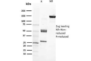 SDS-PAGE Analysis Purified CD29 Mouse Monoclonal Antibody (12G10). (ITGB1 antibody)