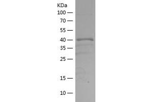 Western Blotting (WB) image for serine/threonine Kinase 11 (STK11) (AA 30-152) protein (His-IF2DI Tag) (ABIN7281913) (LKB1 Protein (AA 30-152) (His-IF2DI Tag))