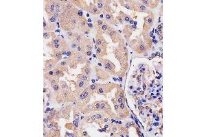 (ABIN390742 and ABIN2841007) staining Villin-1 in human kidney tissue sections by Immunohistochemistry (IHC-P - paraformaldehyde-fixed, paraffin-embedded sections). (Villin 1 antibody  (N-Term))
