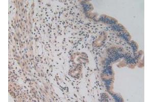 IHC-P analysis of Mouse Uterus Tissue, with DAB staining. (NUP85 antibody  (AA 418-653))