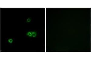 Immunofluorescence analysis of A549 cells, using MARCH5 Antibody. (MARCH5 antibody  (AA 21-70))