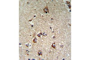 Immunohistochemistry (Paraffin-embedded Sections) (IHC (p)) image for anti-Transferrin Receptor (p90, CD71) (TFRC) (AA 649-677), (C-Term) antibody (ABIN650772)